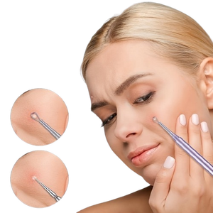 Purple Blackhead Remover Needle with Dual Tips for Face Acne Extraction Tool Facial Spot <b>Extractor</b> Tool - Product Image 5