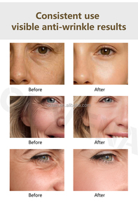 Crèmes de qualité spa, formulées scientifiquement <span class=keywords><strong>pour</strong></span> lutter contre le vieillissement, renouveler le collagène, soulager la <span class=keywords><strong>rosacée</strong></span>, crème santé de pointe - Product Image 3