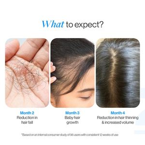 บี-บอดี้ไวส์ เซรั่มบำรุงเส้นผมสูตรโรสแมรี่ 3% (แบบโรลออน) ผสมเรเดนซิล 3% และแอนไกน์ 2% |   ผมหนาขึ้นและแข็งแรงขึ้น |   0.85 ออนซ์ (25 มล.) - Product Image 3