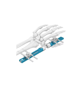 Nuevo Sistema de Fijación Externa de Acero Inoxidable Médico Profesional de Primera Calidad Personalizado 2025, Gran Venta 2024, con Certificación CE - Product Image 5