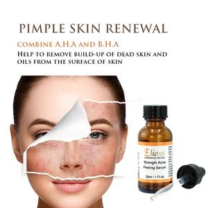 Soin de la peau à marque privée 10% A.H.A 20% B.H.A pour peaux sujettes à l'acné, boutons, points noirs, sérum exfoliant naturel - Product Image 4