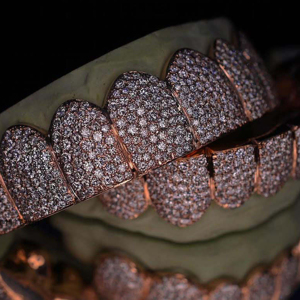 Grillz Hip Hop plaqué or rose et argent 925 avec moissanite taille brillant rond, effet diamant complet, bijoux dentaires unisexe pour soirée - Product Image 6