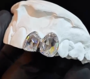 Grillz dentaire solitaire en diamant de laboratoire de forme personnalisée, couleur E, taille fantaisie, certifié par un tiers, fabricant Gujarat RAAMAA - Product Image 2