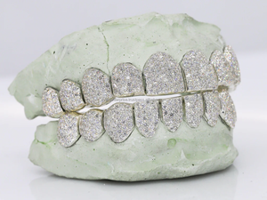 Moissanite Grillz, juego completo hecho a medida totalmente helado Grillz, 925 dientes de diamante de plata esterlina Grillz - Product Image 3