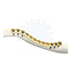 Juego de Instrumentos Quirúrgicos de Acero Inoxidable para Reconstrucción de Clavícula de 3.5mm con Placa de Bloqueo para Fijación de Fracturas de Hombro Ortopédicas - Product Image 1