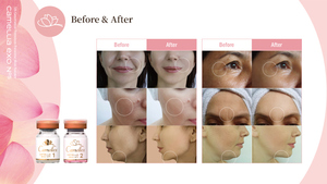 Essence de ADN de saumon PDRN, concentré régénérant pour la peau, sérum hydratant profond pour le visage, pour une texture lisse et une élasticité améliorée - Product Image 3