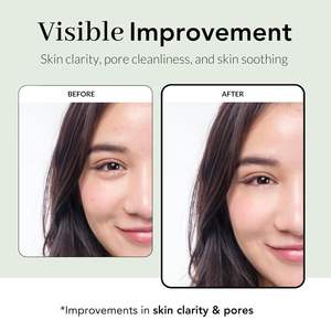 NOWATER Prestige 73 Crème à l'Arbre à Thé 70g |   Masque Peel-Off K-Beauty Soin Anti-Acné Apaisant et Raffermissant pour les Pores, Effet Peau de Verre - Product Image 4