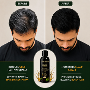 Aceite Anticanas |   Aceite Capilar Herbal Ayurvédico para el Cuidado del Cabello Gris, Nutrición del Cuero Cabelludo y Pigmentación Natural del Cabello |   Venta al por mayor - Product Image 1