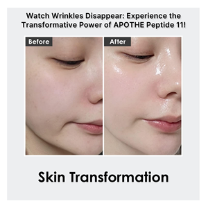 APOTHE Tulip Barrier Ampolla Vegana con Bakuchiol, Botulina y Péptidos 30mL, Sérum Facial Antiedad y Luminosidad, Hecho en Corea - Product Image 2