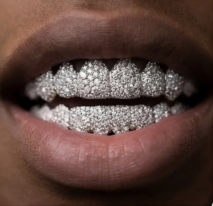 Grillz dentaire unisexe en argent sterling 925, 8 sur 8, avec mosaïque supérieure et inférieure, en moissanite VVS VS, Grillz de qualité supérieure - Product Image 1