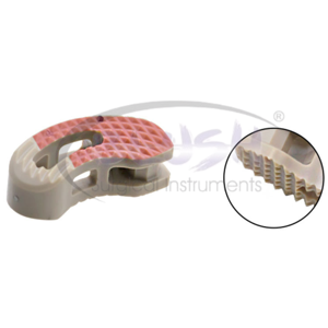 \O-Lumber Interbody Fusion Cage Orthopedic Instruments Sets Stainless Steel Manufactured By <b>Blush</b> Surgical - Product Image 4