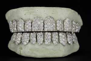 Venta al por mayor de Grillz dentales de plata 925 personalizados con diamantes VVS cultivados en laboratorio, con incrustaciones de diamantes, escaneo dental 3D, proceso rápido y que pasan la prueba del probador de diamantes - Product Image 6