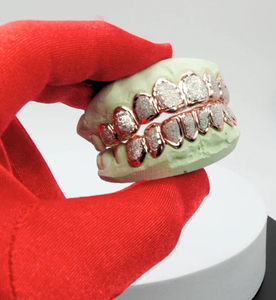 Hiphop Dental Grillz, Juego Completo Chapado en Oro Real de 22k con Banda Roja, Joyería de Moda Unisex para Uso Diario - Product Image 1