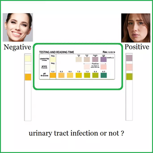 Bandelettes de <span class=keywords><strong>test</strong></span> <span class=keywords><strong>urinaire</strong></span> pour usage domestique OEM, détection rapide des infections urinaires, leucocytes, nitrites, <span class=keywords><strong>pH</strong></span>, 100 bandelettes - Product Image 4