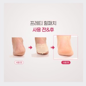 แผ่นแปะเท้าเด็ก Prreti Korean Baby Foot Heel Patch 10 แผ่น ผลิตในเกาหลี 58 กรัม สีขาว ไฮโดรเจล สำหรับทุกเพศทุกวัย - Product Image 3