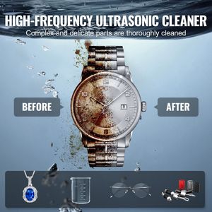 Pulitore a Ultrasuoni Digitale da 15L con Timer e Cestello, 360W, Pulitore Sonico Professionale Elettrico - Product Image 6