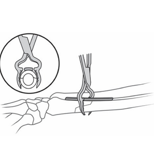 Pinzas de reducción ósea quirúrgicas ortopédicas de acero inoxidable, pinzas de acero personalizadas para huesos - Product Image 6