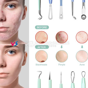 Portable Blackhead <b>Remover</b> Kit With Fine Tip Tools For Gentle Facial Cleaning Daily Skincare And Pore Care Blackhead <b>Remover</b> Kit - Product Image 3