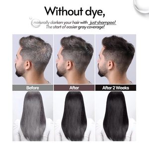 SMIB Shampooing Coréen Changeant de Couleur Couverture des Cheveux Gris Mousse Postbiotique BHA Soin du Cuir Chevelu Teinture Capillaire Naturelle Nourrissante Noir Brun Foncé - Product Image 3