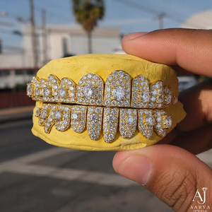 Grillz personnalisés en argent 925 plaqué or rose et or, incrustation de diamants micro-sertis, bijoux hip-hop certifiés IGI, unisexe, pour cadeau de fête - Product Image 1
