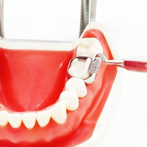 Poussoir et poseur de bandes orthodontiques double extrémité avec détartreur |   Instrument de pose de bande moléaire à pointe courte en acier inoxydable de qualité supérieure - Product Image 3