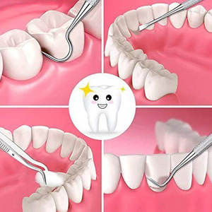 Juego Completo de Instrumentos Dentales Reutilizables para Examen y Entrenamiento, Herramientas Exploradoras Manuales Ergonómicas de Grip Surgical - Product Image 6
