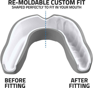 New EVA Mouth Guard for Boxing <b>Training</b>-Anti Grinding Teeth Protection Soft & High Elasticity - Product Image 4