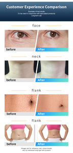 Centre de Réadaptation Sportive : <span class=keywords><strong>Appareil</strong></span> 448K <span class=keywords><strong>pour</strong></span> Soulager les Douleurs Musculaires et Favoriser la Récupération des Blessures - Product Image 5