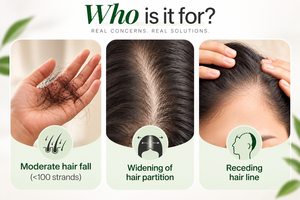 OEM ODM Organic Rosemary <b>Hair</b> Growth <b>Serum</b> Roll 25ml | Redensyl Anagain Scalp Treatment | <b>Hair</b> Fall & Thinning Care <b>for</b> <b>Dry</b> <b>Hair</b> - Product Image 4