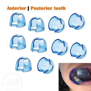 Retractor Bucal Manual Transparente Azul para Labios y Mejillas, Modelo de Entrenamiento Médico para Procedimientos Orales - Product Image 3