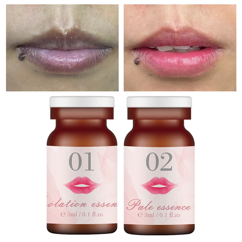 Dark Lips to Pink Color Removal