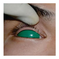 Protège-yeux en silicone pour la chirurgie des paupières (blépharoplastie) – Lot de 6 instruments chirurgicaux Medtrust de qualité supérieure ISO/CE à prix réduit