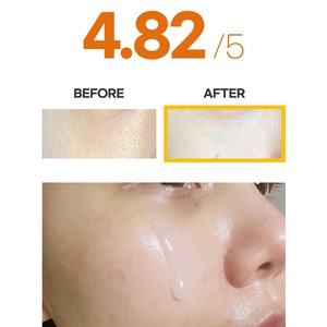 Suero Facial Coreano K-Beauty 100ml con Vitamina C, Niacinamida y Arbutina en Ampolla - Product Image 3