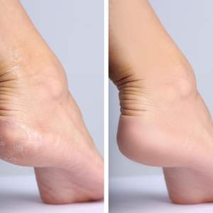 Exfoliante de pies de madera UBI con mango largo de madera y papel de lija para eliminar callosidades, piel muerta, pies y talones secos, para usar en la ducha. - Product Image 4