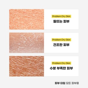 ครีมบำรุงผิวหน้า Korea K-Beauty Blemish Shot 30 มล. ไนอะซินาไมด์ ทรานเน็กซามิก แอซิด อะดีโนซีน กลูโคโนแลคโตน สำหรับผิวเป็นสิวง่าย ช่วยลดเลือนริ้วรอย - Product Image 5