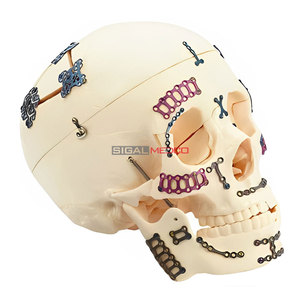 Juego de Instrumentos Quirúrgicos Manuales para Reconstrucción Maxilofacial con Placa L de 2.4mm, para Fijación Ósea Precisa en Cirugía Ortopédica y Traumatología - Product Image 5