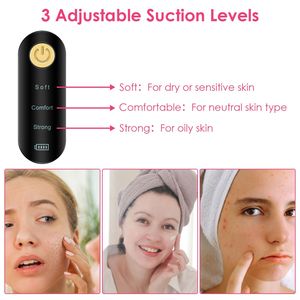 Electric Facial Pore Cleaner & <b>Blackhead</b> <b>Extractor</b> Tool <b>Blackhead</b> Vacuum Remover for Acne & Comedone Removal Pimple Suction Tool - Product Image 4