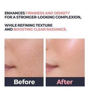 Suero Antiedad PDRN 15ml, Suero Reparador de Barrera para una Piel Radiante, con ADN para Rellenar, Ligero, Antiedad, No Grasoso, con Efecto Rocío Celular - Product Image 3