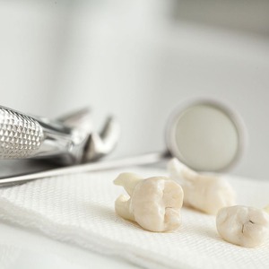 Pinzas de Extracción Dental # Instrumentos Quirúrgicos Reutilizables y Autoclavables de Acero Inoxidable Alemán 222, de Alta Calidad - Product Image 4