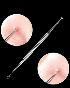 High Durability & Sustainable Pore Cleaner Face Acne <b>Extractor</b> Skin Care Tools <b>Blackhead</b> Remover Acne Remover Instrument - Product Image 6