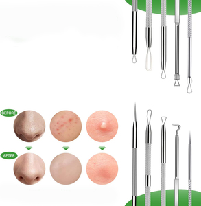 Extractor de Puntos Negros de Doble Punta, Aguja para Eliminar Acné, Limpiador Facial de Poros, Instrumento de Belleza de Acero Inoxidable - Product Image 4