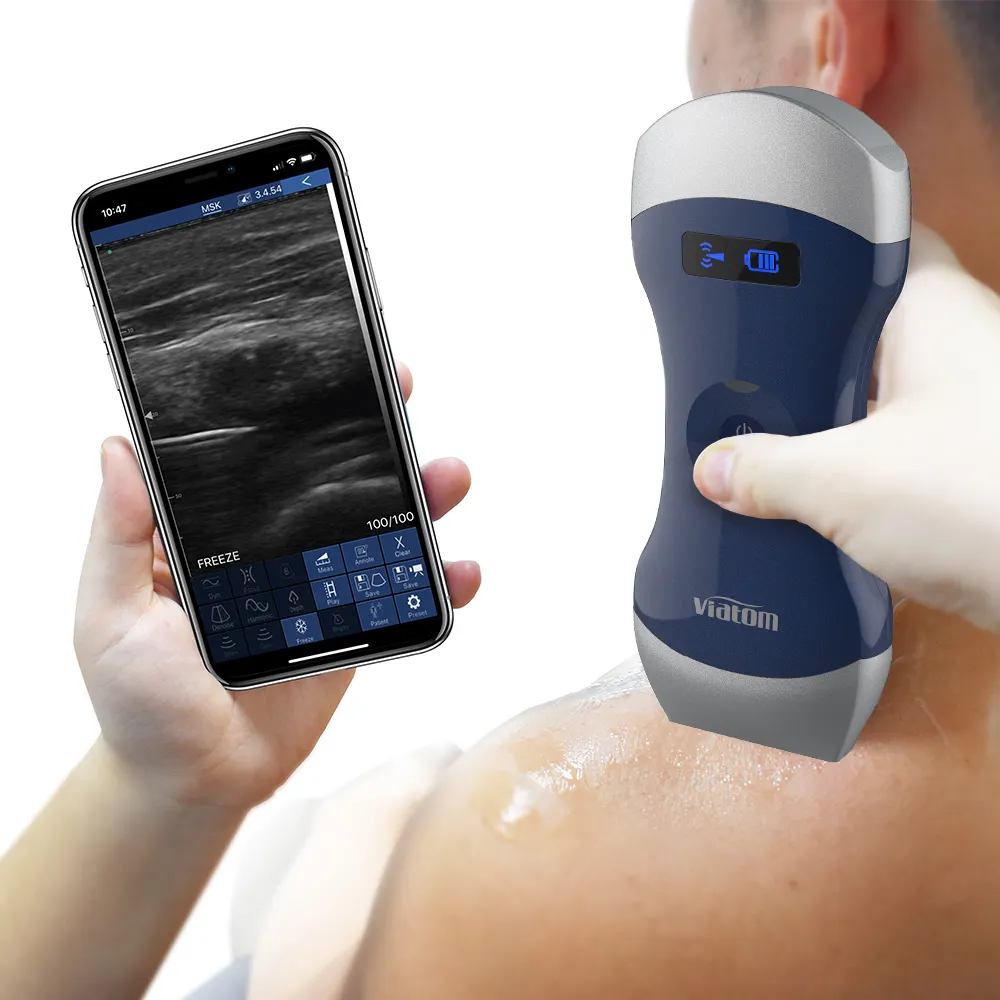 Ultrassom viatom convexo e linear 2 sondas, solução de diagnóstico de corpo inteiro, doppler portátil