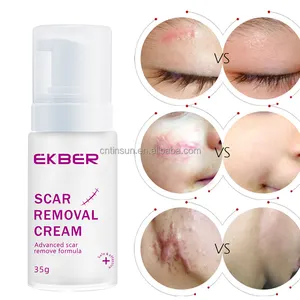 Burn Littekens Puistjes Anti Puistje Acne Mark Been Keloid Litteken Verwijderen Gel Chirurgisch Tcm Litteken Verwijdering Crème