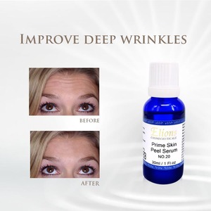 Deep Penetration Anti-Pigment Rejuvenating Face Body Brightening Wrinkle Brightening Hands 20% <b>Prime</b> Acid Peeling Serum - Product Image 2