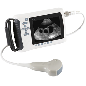 Échographe portable numérique médical MT, échographe portable pour vétérinaire, meilleur appareil d'échographie à domicile pour le <span class=keywords><strong>test</strong></span> <span class=keywords><strong>de</strong></span> <span class=keywords><strong>grossesse</strong></span> des vaches - Product Image 2