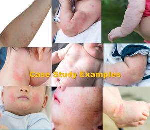 Crema calmante para bebé, Eczema, pañal de picazón, crema hidratante para loción corporal blanqueadora, a precio de fábrica - Product Image 2