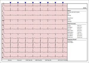 Electrocardiograma para uso veterinario, electrocardiograma para interpretación de ECG para perros, taquicardia y Ventricular - Product Image 3