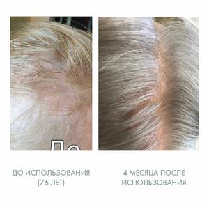 Nouveau produit 2021 Crème anti-âge 5% Complexe Capixil pour la perte de cheveux et la thérapie de repousse des cheveux Meilleur fournisseur russe Prix bas - Product Image 6