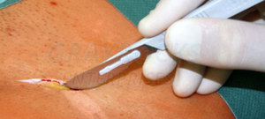 Oem Service Best Price Dental Scalpel Handle Adjustable Scalpel Handle Rotatable Surgical Instruments - Product Image 6