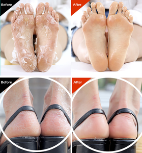 Feuille de Peeling des pieds, produit coréen, pour le traitement, fabriqué en corée, Essence hydratante, apaisante, beauté, 1 pièce, OEM/ODM - Product Image 6